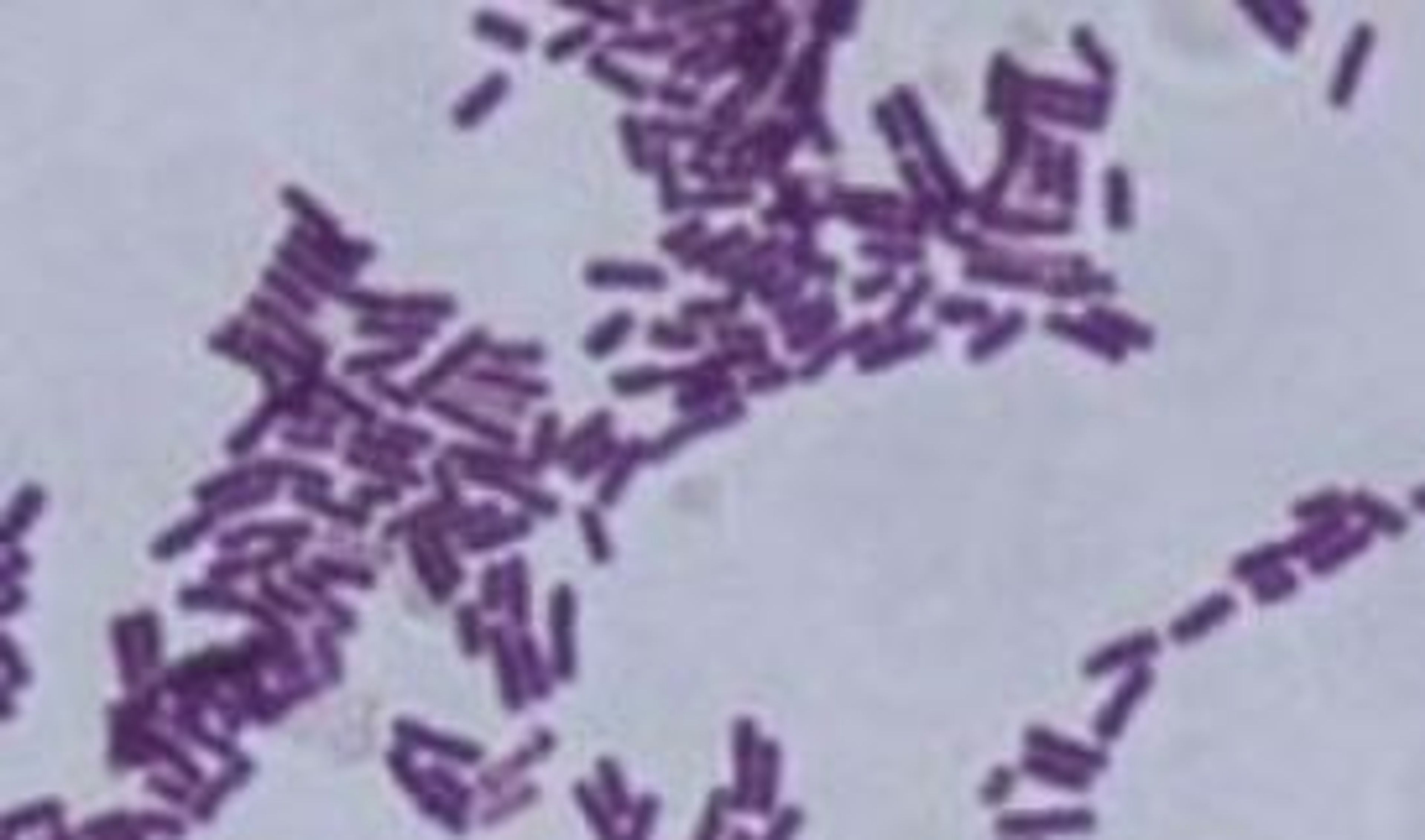 Philip Harris Bacterial Culture - Bacillus Subtilis | B8A16056